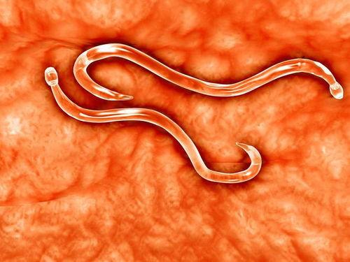 吃瓜会长蛔虫吗,揭秘吃瓜与蛔虫感染的关系